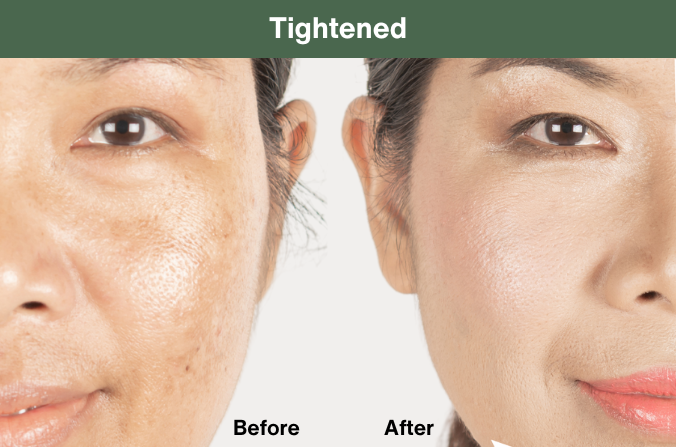 Skin restoration face serum